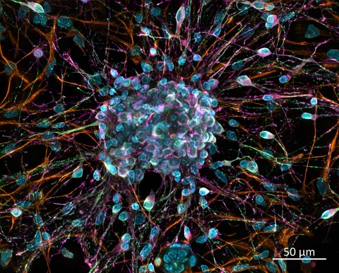 A rat cortical neuron culture, deconvolved z-stack — the kind of network that grows, unbidden, when neurons are plated on a chip. Within days they are wiring themselves together and bursting with activity (ZEISS Microscopy, CC BY 2.0).