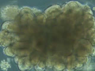 A brain organoid during development — a self-assembled ball of neural tissue a fraction of a millimetre wide. Sixteen of these, on electrode arrays, are what a FinalSpark customer rents (NIH Image Gallery, public domain).