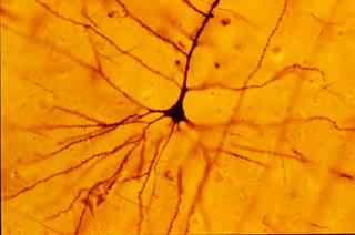 A Golgi-stained pyramidal neuron — the black reaction in action: a sparse, random few cells turn completely black, their entire arbor visible at once (CC BY-SA 3.0).